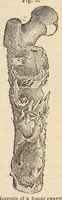 An illustration from The American journal of the medical sciences (1827)
