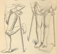An illustration from The American journal of the medical sciences (1827)