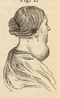 An illustration from The American journal of the medical sciences (1827)