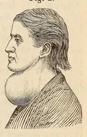 An illustration from The American journal of the medical sciences (1827)