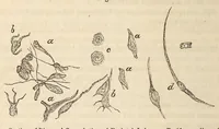 An illustration from The American journal of the medical sciences (1827)