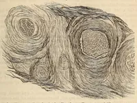 An illustration from The American journal of the medical sciences (1827)