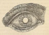An illustration from The American journal of the medical sciences (1827)