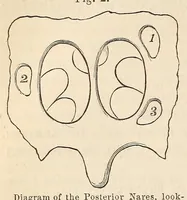 Picture 9 of 13 from The American journal of the medical sciences (1827), leaf 360