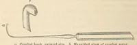 An illustration from The American journal of the medical sciences (1827)
