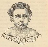An illustration from The American journal of the medical sciences (1827)