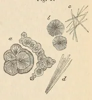 An illustration from The American journal of the medical sciences (1827)