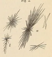 An illustration from The American journal of the medical sciences (1827)