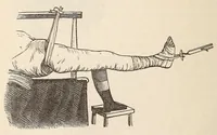An illustration from The American journal of the medical sciences (1827)