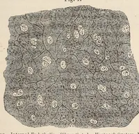 Picture 5 of 15 from The American journal of the medical sciences (1827), leaf 315