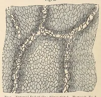 An illustration from The American journal of the medical sciences (1827)