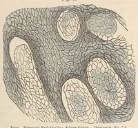 Picture 7 of 15 from The American journal of the medical sciences (1827), leaf 317
