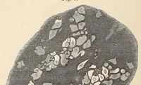 An illustration from The American journal of the medical sciences (1827)