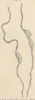 Picture 11 of 15 from The American journal of the medical sciences (1827), leaf 321