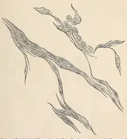Picture 13 of 15 from The American journal of the medical sciences (1827), leaf 323