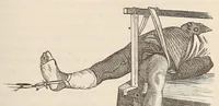 An illustration from The American journal of the medical sciences (1827)