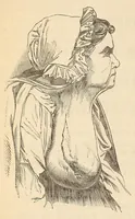 An illustration from The American journal of the medical sciences (1827)