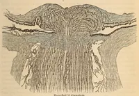 An illustration from The American journal of the medical sciences (1827)
