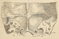 An illustration from The American journal of the medical sciences (1827)