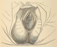 An illustration from The American journal of the medical sciences (1827)