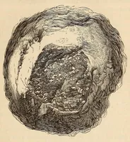 An illustration from The American journal of the medical sciences (1827)
