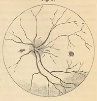 An illustration from The American journal of the medical sciences (1827)