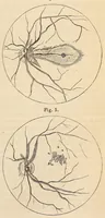 An illustration from The American journal of the medical sciences (1827)