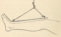 An illustration from The American journal of the medical sciences (1827)