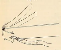 An illustration from The American journal of the medical sciences (1827)