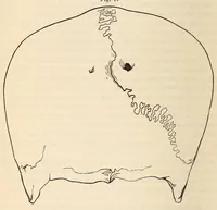 An illustration from The American journal of the medical sciences (1827)