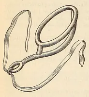 An illustration from The American journal of the medical sciences (1827)