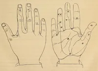 An illustration from The American journal of the medical sciences (1827)