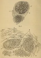 An illustration from The American journal of the medical sciences (1827)
