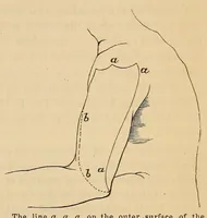An illustration from The American journal of the medical sciences (1827)