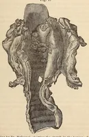 An illustration from The American journal of the medical sciences (1827)