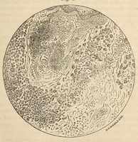 Picture 8 of 12 from The American journal of the medical sciences (1827), leaf 409