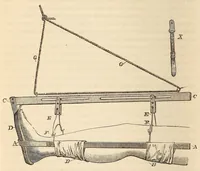 Picture 10 of 12 from The American journal of the medical sciences (1827), leaf 444