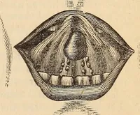 An illustration from The American journal of the medical sciences (1827)