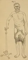 An illustration from The American journal of the medical sciences (1827)