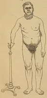 An illustration from The American journal of the medical sciences (1827)