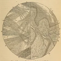 An illustration from The American journal of the medical sciences (1827)