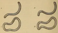 An illustration from The American journal of the medical sciences (1827)