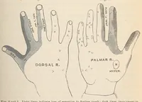 An illustration from The American journal of the medical sciences (1827)