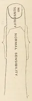 Picture 10 of 16 from The American journal of the medical sciences (1827), leaf 332