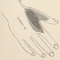 An illustration from The American journal of the medical sciences (1827)