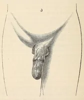 An illustration from The American journal of the medical sciences (1827)