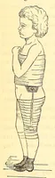An illustration from The American journal of the medical sciences (1827)