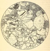 An illustration from The American journal of the medical sciences (1827)