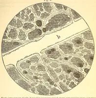An illustration from The American journal of the medical sciences (1827)