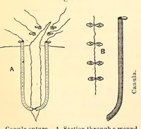 Picture 16 of 18 from The American journal of the medical sciences (1827), leaf 452